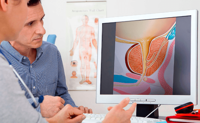Diagnosi di prostatite